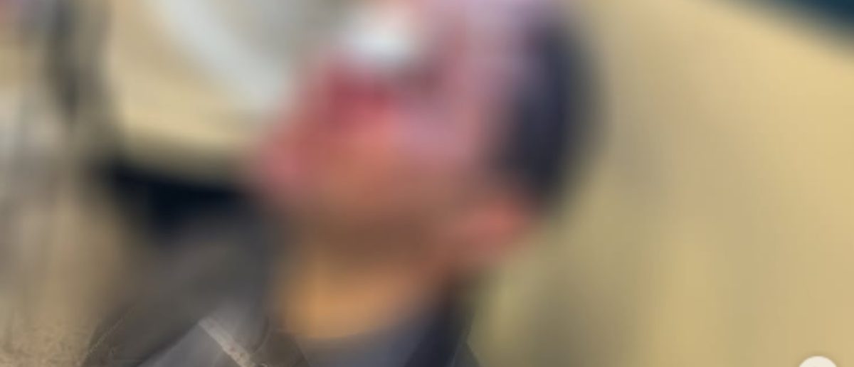 Επίθεση στη Νομική Αθηνών: «Μία έγκυος υπέστη σοκ»