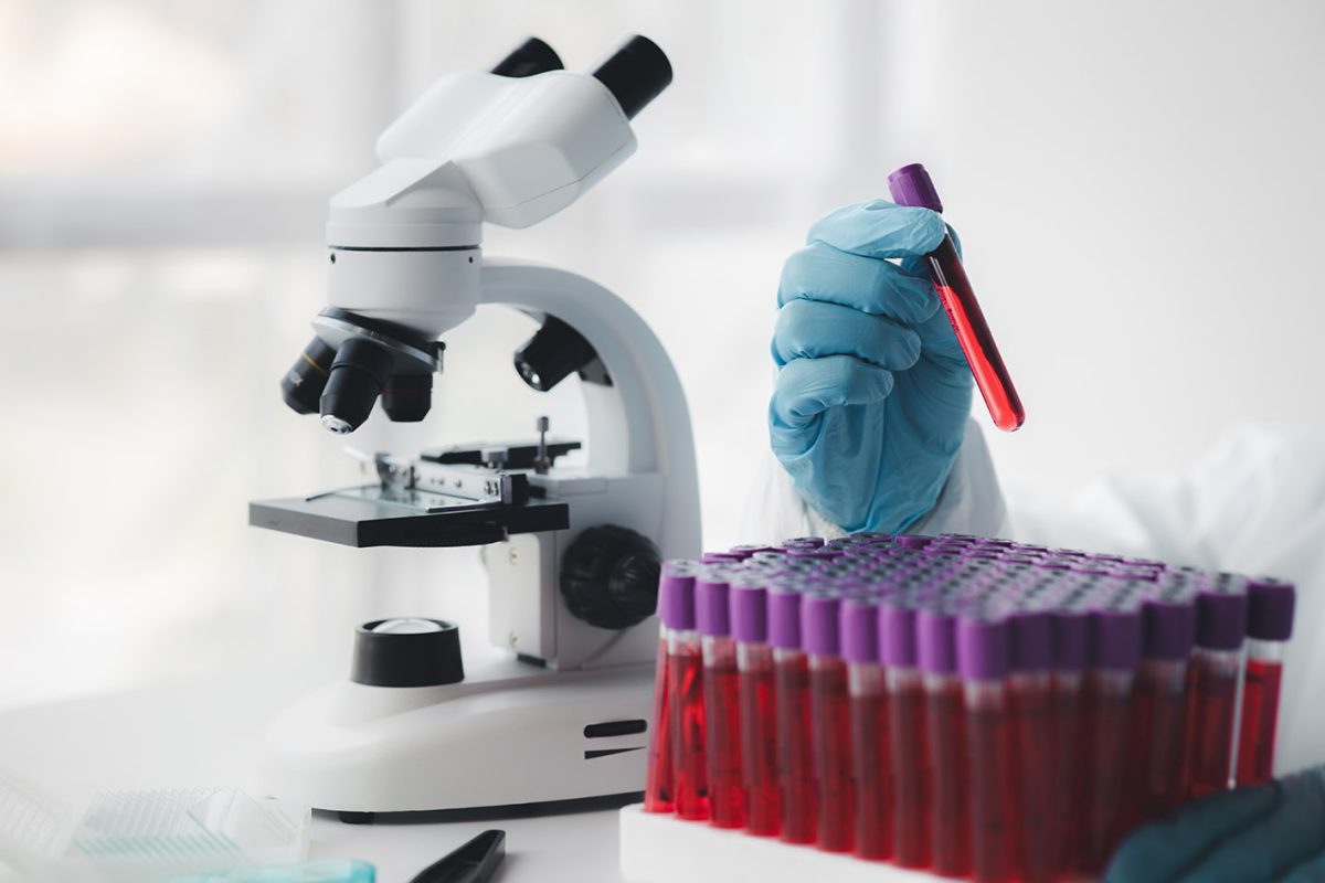 Ένα θαύμα επιστήμης από την Ιαπωνία: Τεχνητό αίμα που υπόσχεται να σώσει ζωές σε κρίσιμες στιγμές