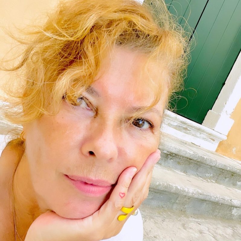 Σοφία Αλιμπέρτη: Δείχνει πώς κάνει αισθητικό βελονισμό στο πρόσωπο