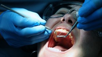 Η ουλίτιδα μπορεί να συνδέεται με αυξημένο κίνδυνο σοβαρών καρδιαγγειακών επεισοδίων