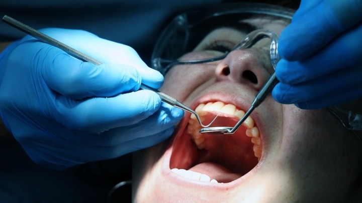 Η ουλίτιδα μπορεί να συνδέεται με αυξημένο κίνδυνο σοβαρών καρδιαγγειακών επεισοδίων