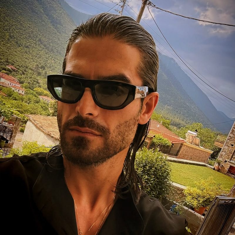 Άρης Μουγκοπέτρος: Δείχνει τα δύο πρόσθετα δάχτυλα μετά τον ακρωτηριασμό του